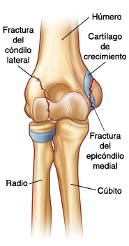 Humerus bone: anterior Diagram