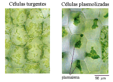 solución isotónica célula vegetal