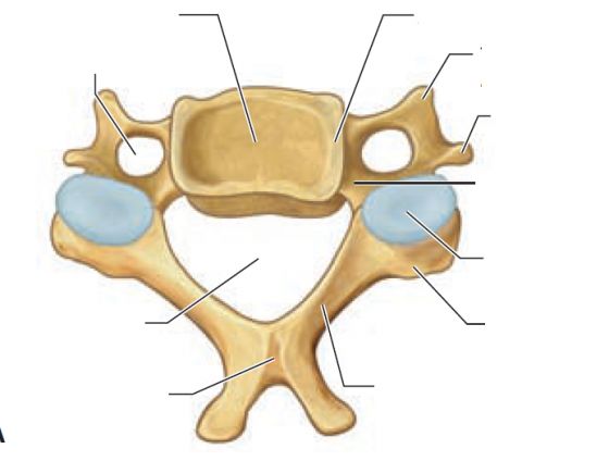 Print Map Quiz: Vertebra Cervical ()