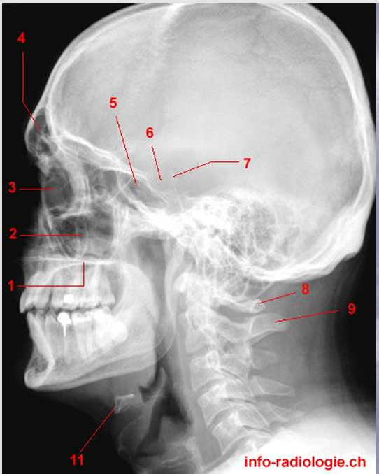 Mapa Interactivo: Anatomia - Lateral de crani