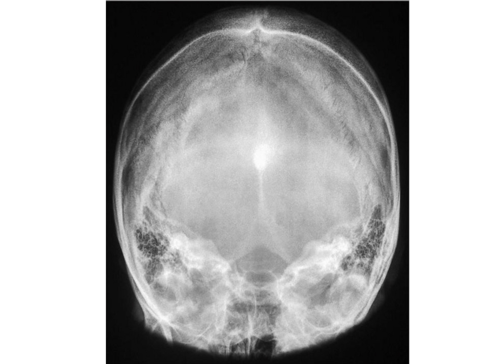 Relacionar Columnas: RAD5066 - Skull & Facial Projections (imaging - x ...