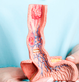 The esophagus transports food to the stomach through peristaltic movements.