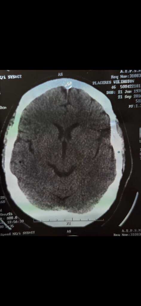 ¿Qué son las partes más oscuras en el centro del cerebro? 