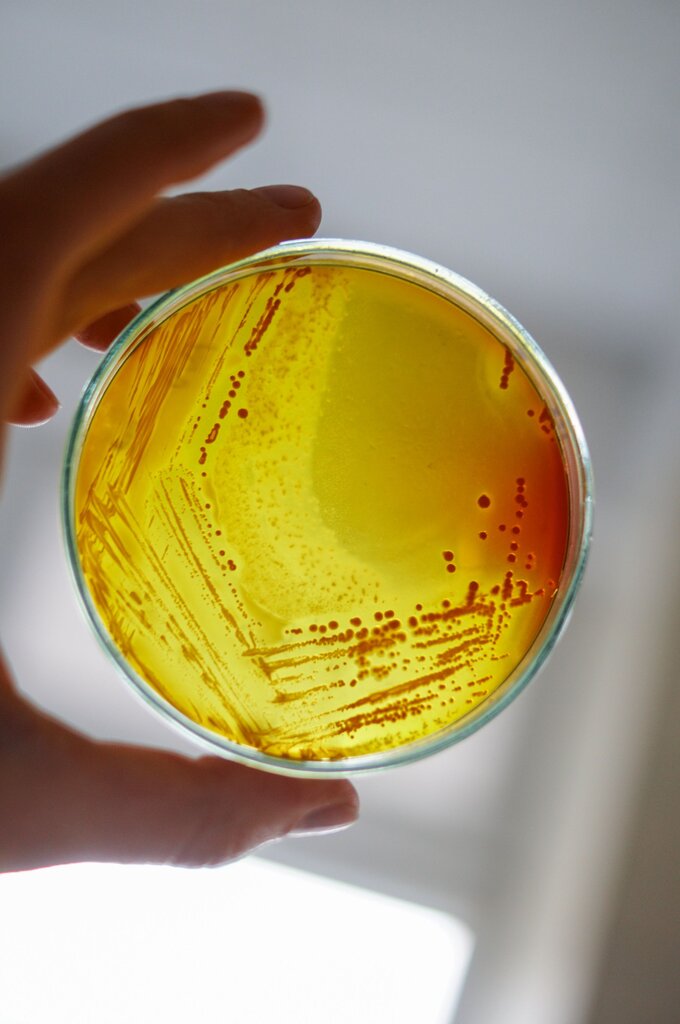 bacteria