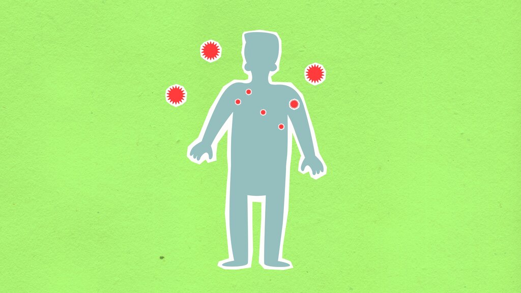 Influenza