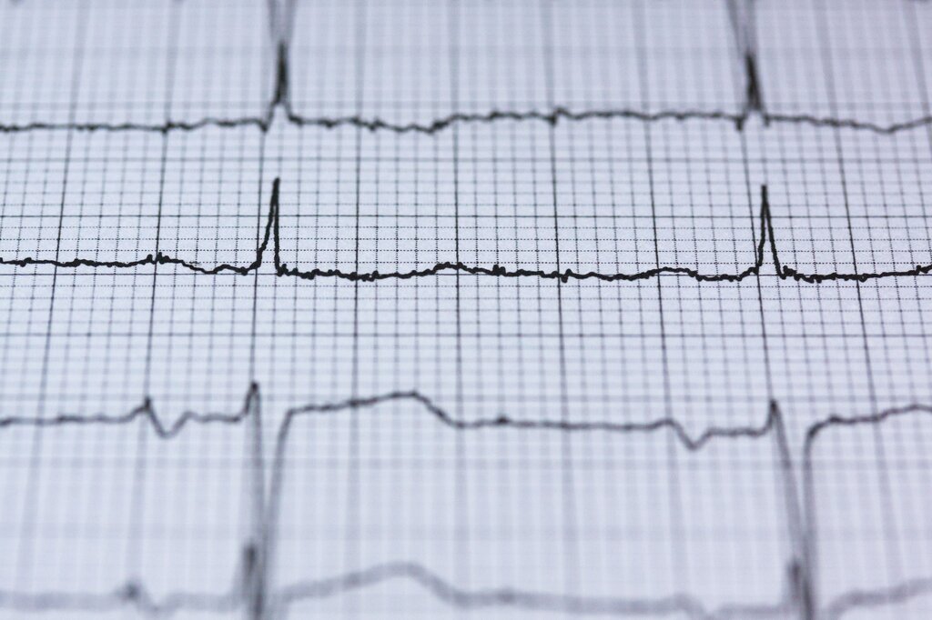 ¿Qué células actúan como el marcapasos eléctrico determinando el ritmo de las ondas lentas en el músculo liso gastrointestinal?