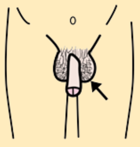 Pene