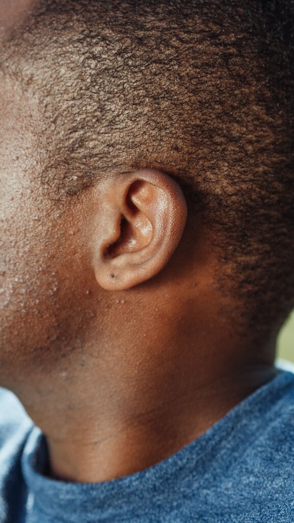 oreja